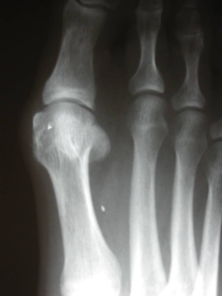 Through the Eyes of a Student Podiatrist